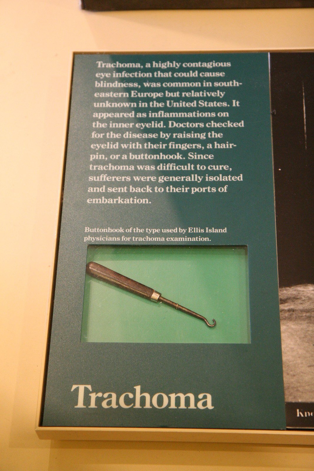 A historical trachoma exhibit showing an eyelid-treatment instrument